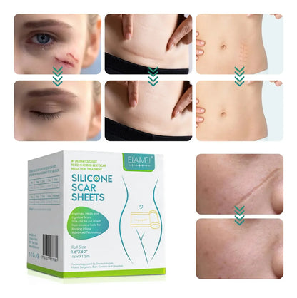 Cinta Eliminación Cicatrices